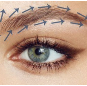 Eyebrow transplantation