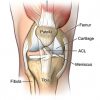 Surgery of knee ligaments