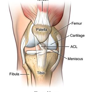Surgery of knee ligaments