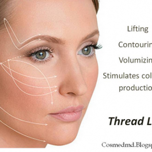Face lift with thread
