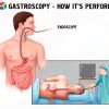 Upper GI endoscopy