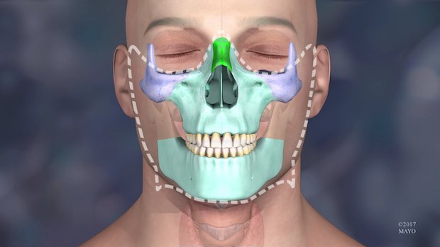 List of the best maxillofacial surgeons in Iran