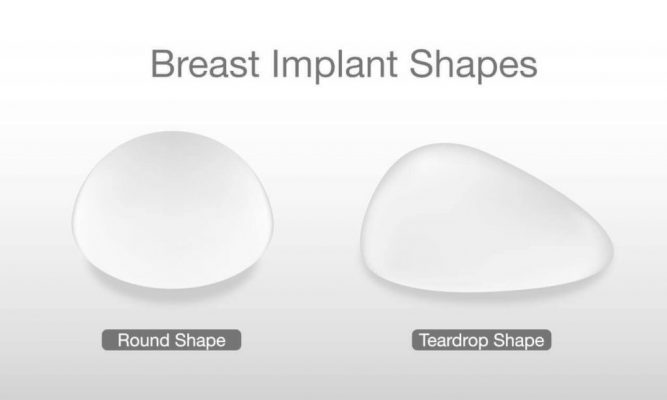 price of breast implants in Iran