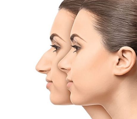 best country for rhinoplasty