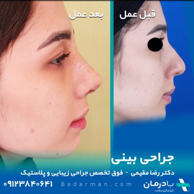 Dr reza Moghimi - Plastic Surgeon in Iran - Rhinoplasty in Iran