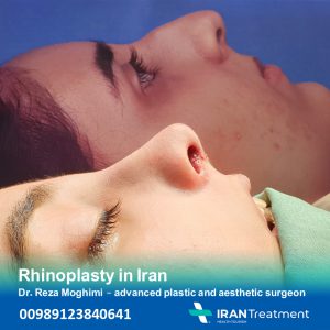 Rhinoplasty in Iran - Dr. Mohammad Reza Moghimi