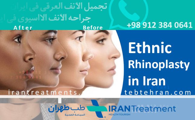 ethnic rhinoplasty in Iran