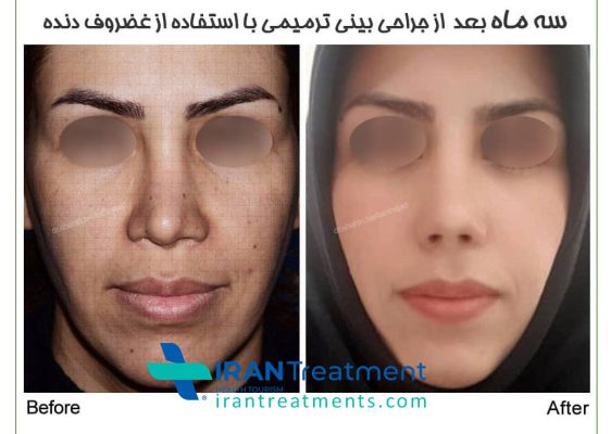 Dr. shahin bastaninejad - nose surgeon - Otolaryngologist (ENT)