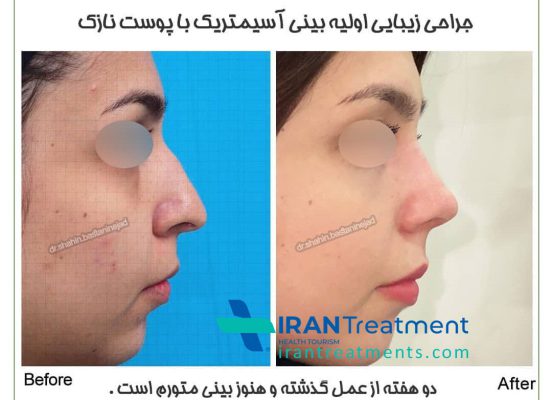 Dr. shahin bastaninejad - nose surgeon - Otolaryngologist (ENT)