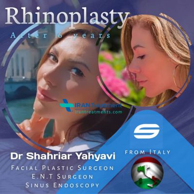 dr. Shahriyar Yahyavi - Nose job in Iran
