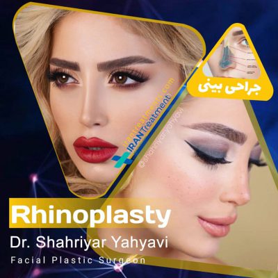 dr. Shahriyar Yahyavi - Best Nose job surgeon in Iran