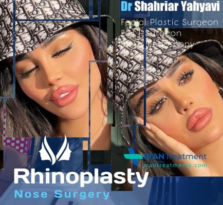 dr. Shahriyar Yahyavi - Rhinoplasty in Iran