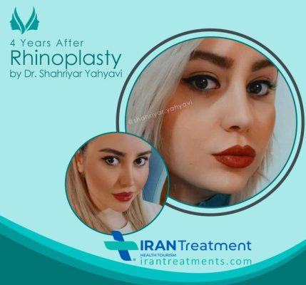 dr. Shahriyar Yahyavi - Rhinoplasty in Iran