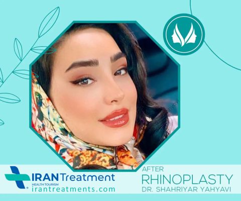dr. Shahriyar Yahyavi - Otolaryngologist (ENT) in Iran