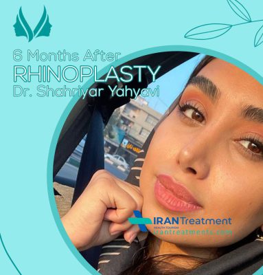 dr. Shahriyar Yahyavi - Nose job in Iran