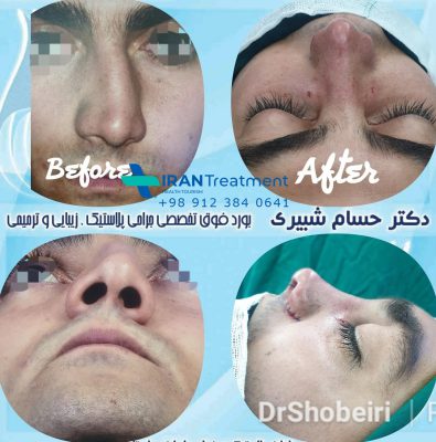 Dr. Shobeiri - nose surgeon - plastic surgeon specialist