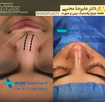 dr. Alireza Mohebbi - Otolaryngologist (ENT) in Iran