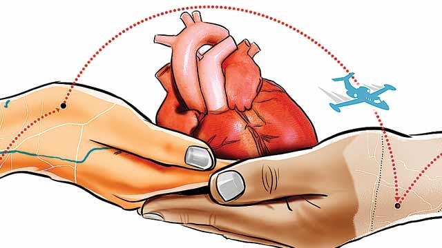 Heart transplant in Iran