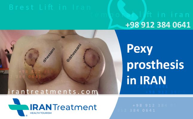 Pexy prosthesis in Iran - Breast augmentation
