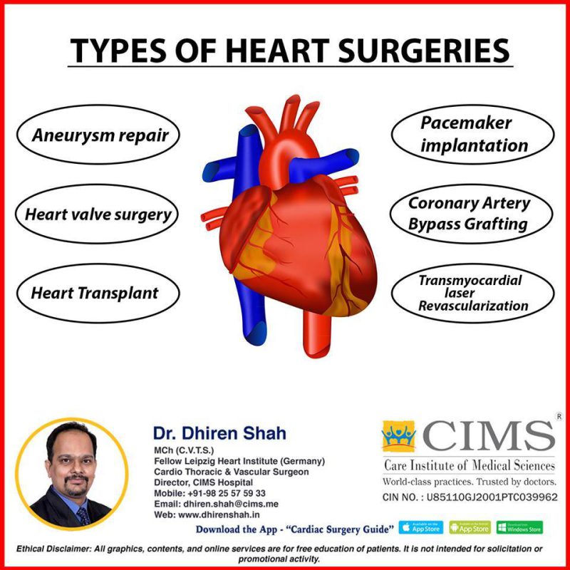 Heart surgery in Iran