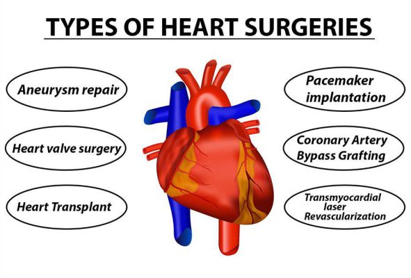 Heart surgery in Iran